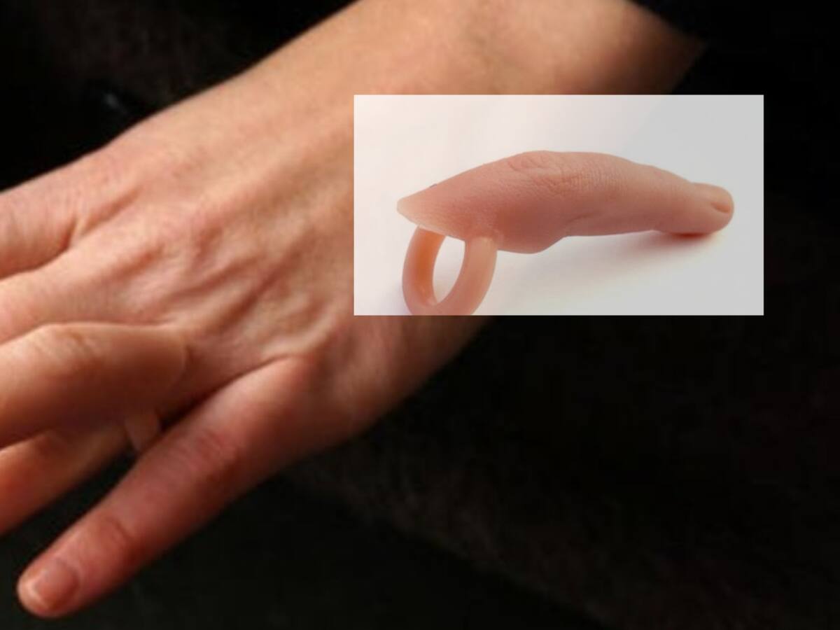 Criminales venden “anillos prostéticos” para hacer que imágenes parezcan generaas por IA